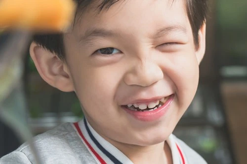Tips Menerapkan Pola Hidup Sehat dan Makanan Sehat Bergizi untuk Anak