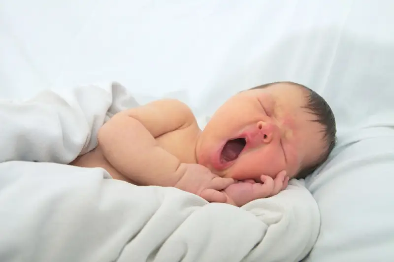 7 Cara Mengatasi Bayi Kuning dengan Cepat