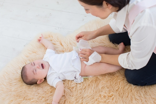 Bayi Sering BAB Sedikit: 6 Penyebab + Perawatan